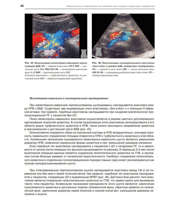 Абдоминальное ультразвуковое исследование при синдроме портальной гипертензии 