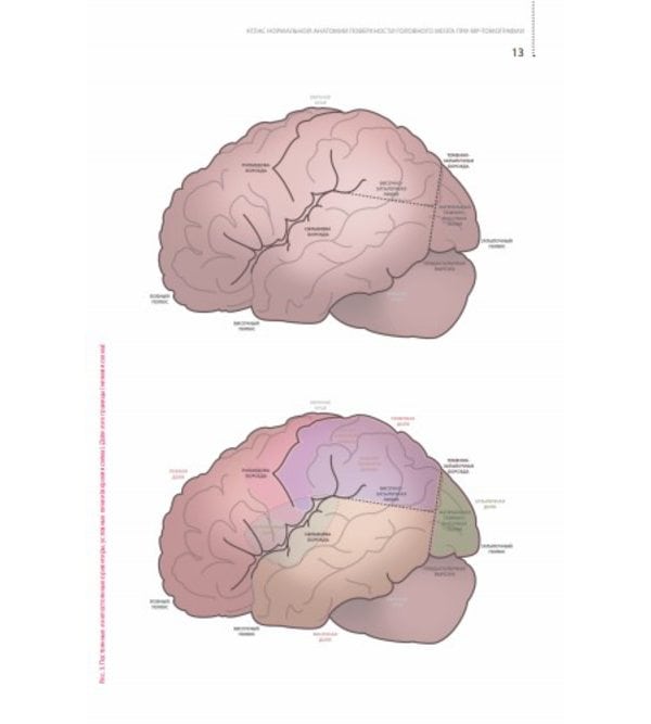 Атлас нормальной анатомии поверхности головного мозга при МР-томографии