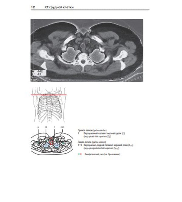 Атлас секционной анатомии человека на примере КТ и МРТ-срезов. Т.2. Внутренние органы