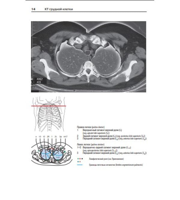 Атлас секционной анатомии человека на примере КТ и МРТ-срезов. Т.2. Внутренние органы