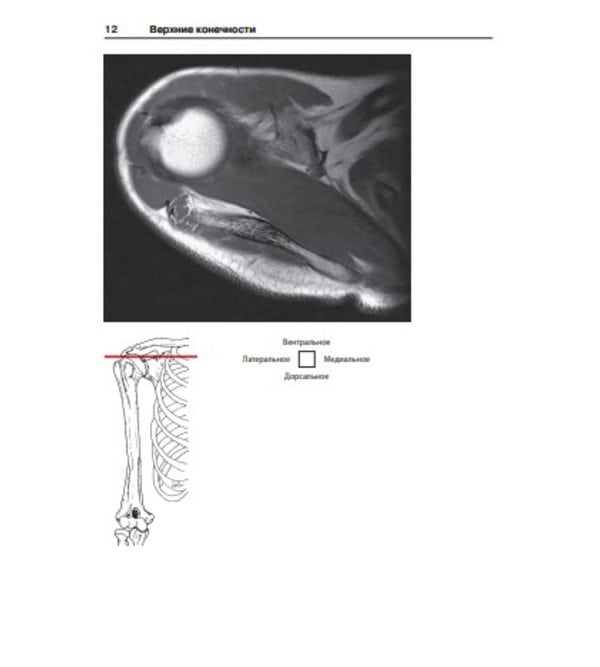 Атлас секционной анатомии человека на примере КТ и МРТ-срезов. Т.3. Позвоночник, конечности, суставы