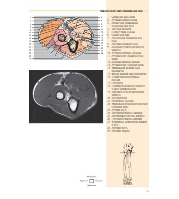 Атлас секционной анатомии человека. Костно-мышечная система