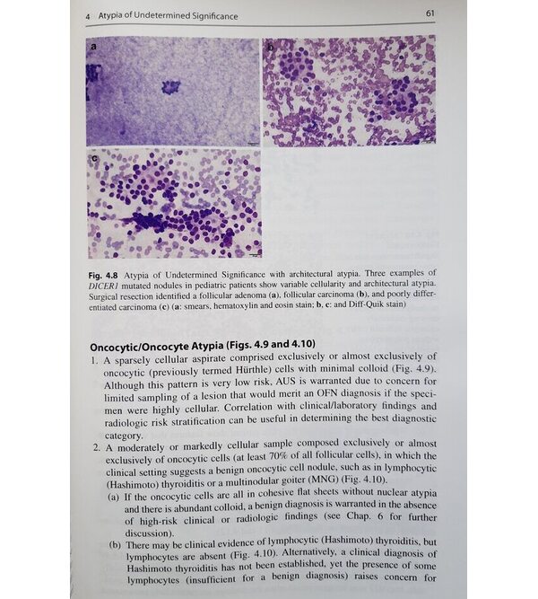Класифікація Бетесда для цитологічної діагностики захворювань щитовидної залози (The Bethesda System for Reporting Thyroid Cytopathology)