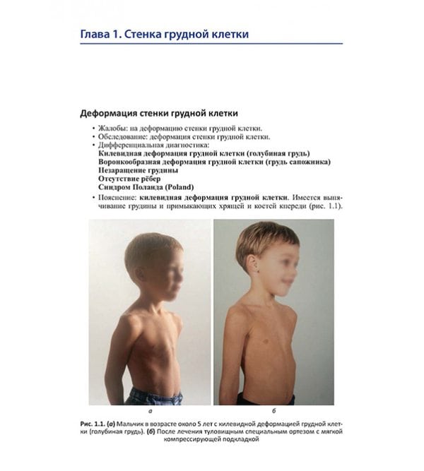 Детская ортопедия. Симптомы, дифференциальная диагностика, дополнительное обследование и лечение