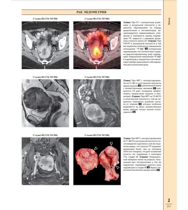 Диагностическая визуализация в гинекологии. Том 1