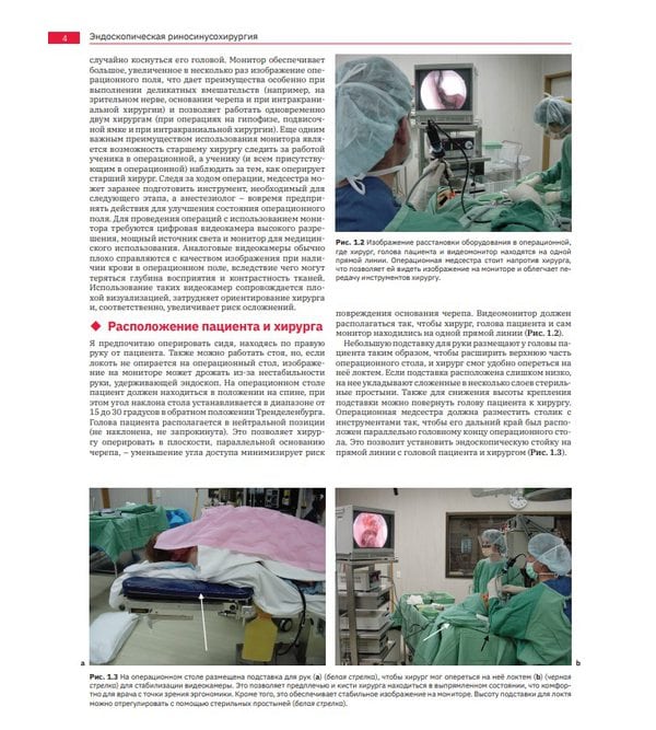 Эндоскопическая риносинусохирургия. Анатомия, объемная реконструкция и хирургическая техника