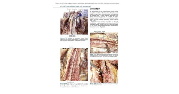 Клинические　фотографии　тела,　приложение　к　Gray's　Anatomy