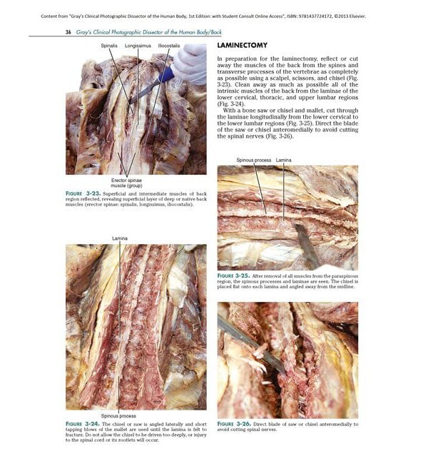 Анатомія Грея в фотографіях (Gray's Clinical Photographic Dissector of the Human Body)