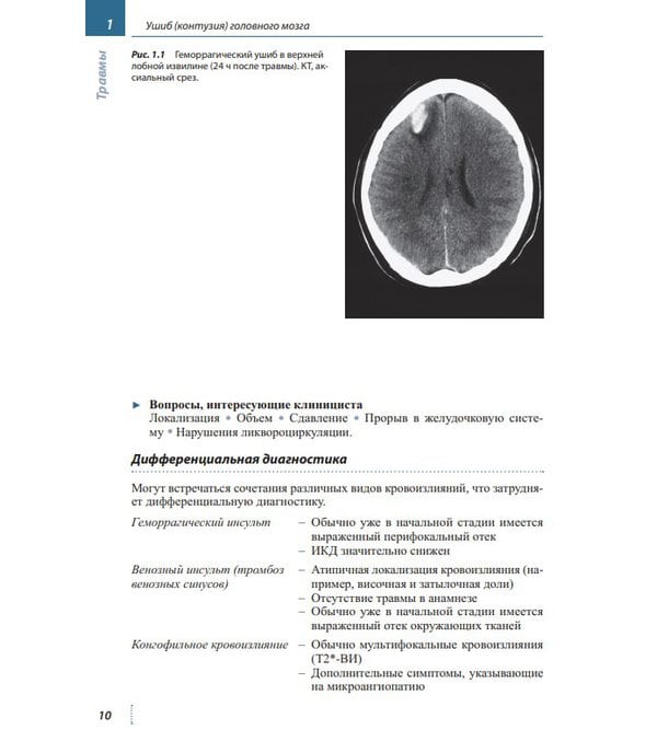Лучевая диагностика. Головной мозг