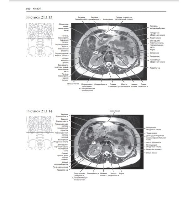 МРТ и КТ. Секционная анатомия                              