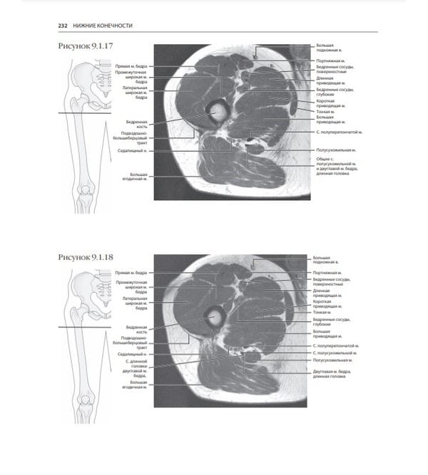 МРТ и КТ. Секционная анатомия                              
