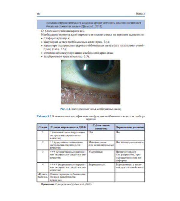 Синдром «сухого глаза»: практический подход