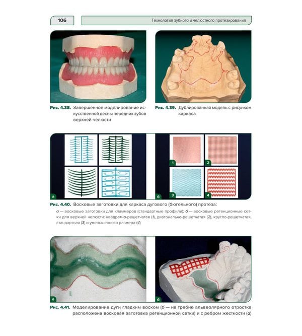 Технология зубного и челюстного протезирования