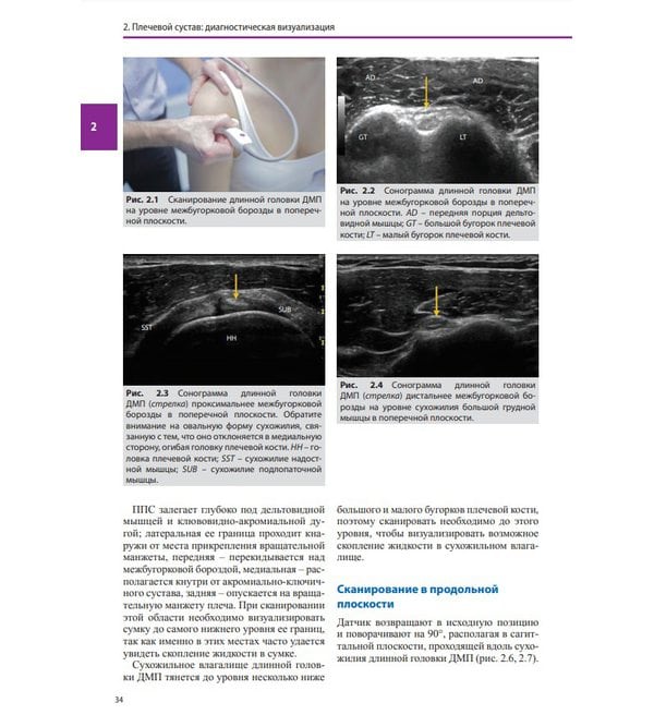 Ультразвуковая диагностика болезней костно-мышечной системы и инъекции под ультразвуковым контролем