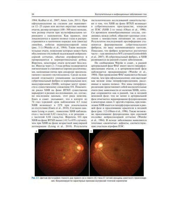 Воспалительные и инфекционные заболевания глаз