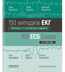 150 випадків ЕКГ=150 ECG Cases