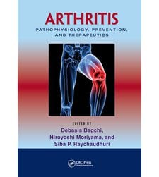 Arthritis Pathophysiology, Prevention, and Therapeutics