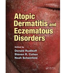 Атопічний дерматит та екзематозні захворювання (Atopic Dermatitis and Eczematous Diso..