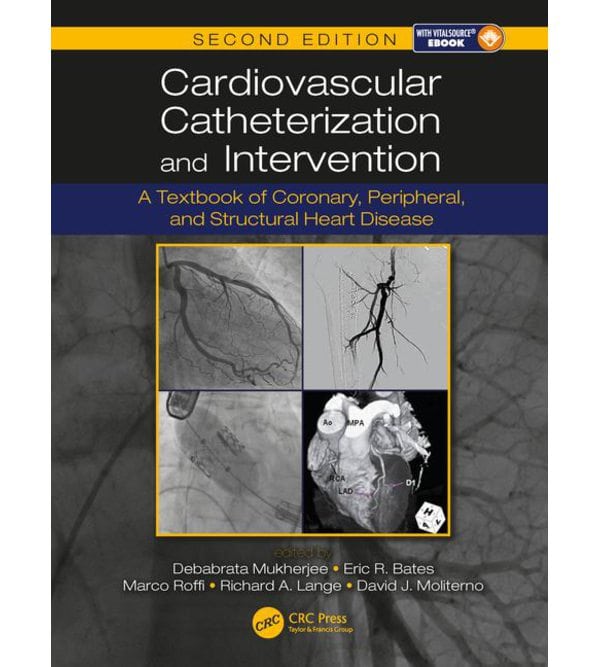 Катетеризація серцево-судинної системи (Cardiovascular Catheterization and Intervention)