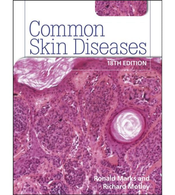 Common Skin Diseases 18th edition
