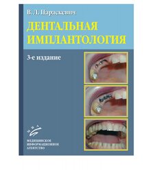 Дентальная имплантология
