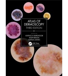 Атлас дерматоскопії (Atlas of Dermoscopy)