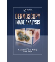 Dermoscopy Image Analysis