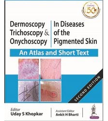 Dermoscopy, Trichoscopy & Onychoscopy in Diseases of the Pigmented Skin (An Atlas and..