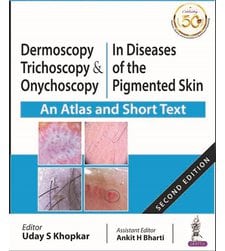Dermoscopy, Trichoscopy & Onychoscopy in Diseases of the Pigmented Skin (An Atlas and Short Text)