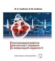 Електрокардіографічна діагностика і лікування в невідкладній кардіології