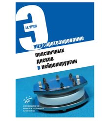 Эндопротезирование поясничных дисков в нейрохирургии 
