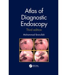 Атлас діагностичної ендоскопії (Atlas of Diagnostic Endoscopy)