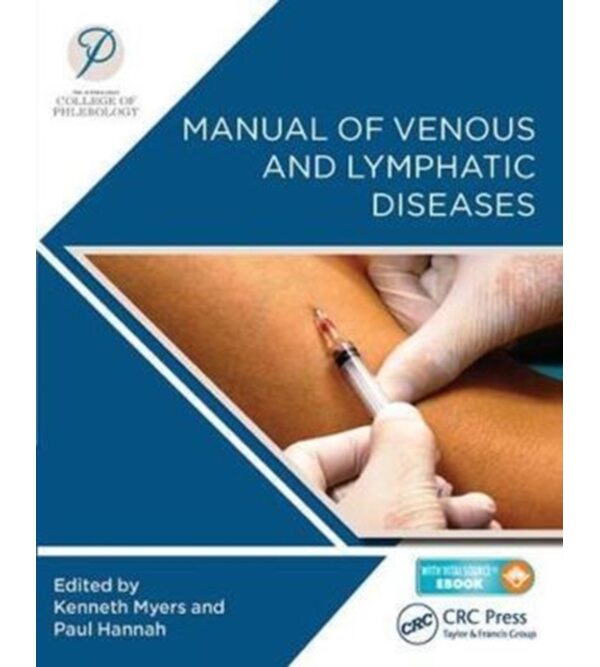Manual of Venous and Lymphatic Diseases (Посібник з хвороб вен і лімфи)