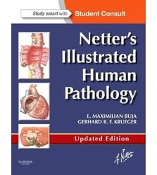 Патологія людини з ілюстраціями Неттера (Netter's Illustrated Human Pathology) 