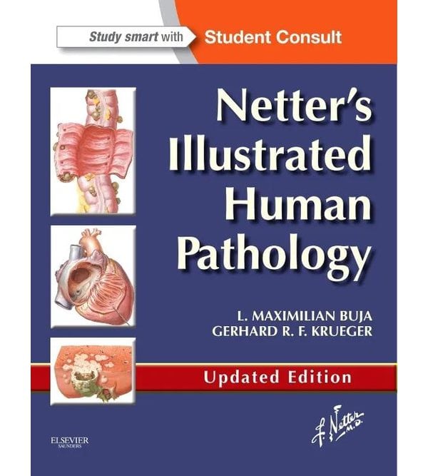 Netter's Illustrated Human Pathology 