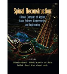 Spinal Reconstruction