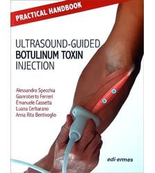 Practical Handbook for Ultrasound-guided Botulinum Toxin Injection