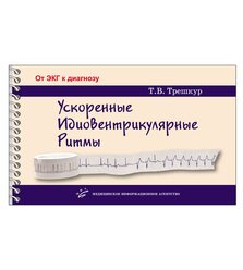 Ускоренные идиовентрикулярные ритмы