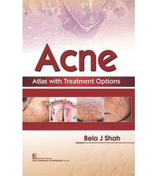 Acne Atlas with Treatment Options