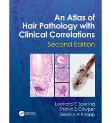 An Atlas of Hair Pathology with Clinical Correlations