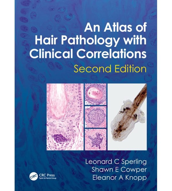 Атлас патології волосся з клінічними кореляціями (An Atlas of Hair Pathology with Clinical Correlations)