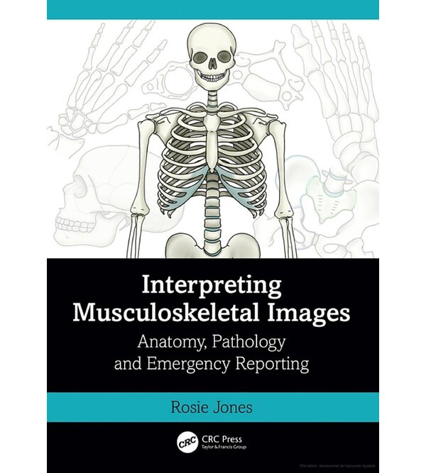 Interpreting Musculoskeletal Images (Інтерпретація зображень опорно-рухового апарату)