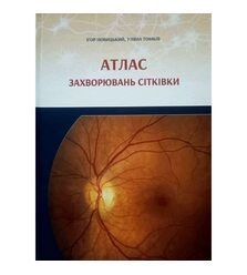 Атлас захворювань сітківки