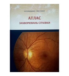 Атлас захворювань сітківки