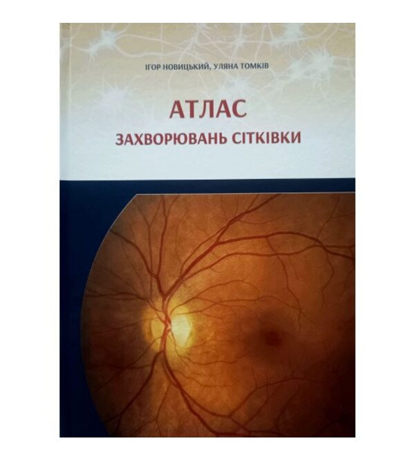 Атлас захворювань сітківки