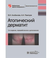 Атопический дерматит