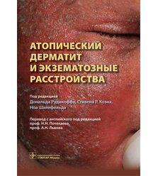 Атопический дерматит и экзематозные расстройства