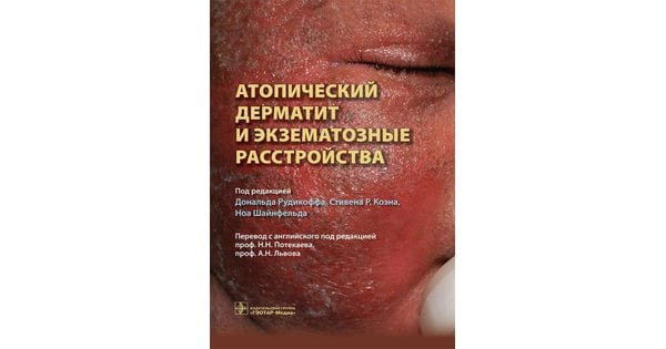 Книга Атопический дерматит и экзематозные расстройства