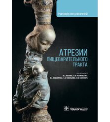 Атрезии пищеварительного тракта