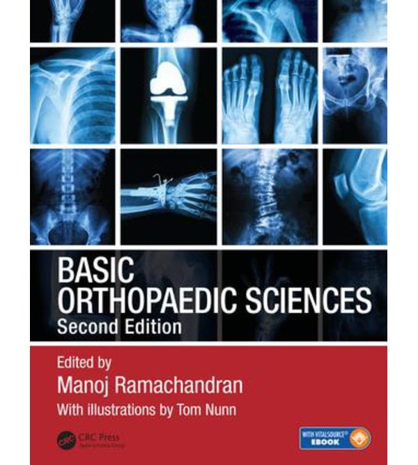 Основи ортопедії (Basic Orthopaedic Sciences)